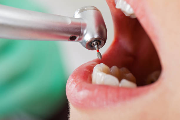 Best Urgent Care for Lost Fillings or Crowns in Bridgewater Center, NJ